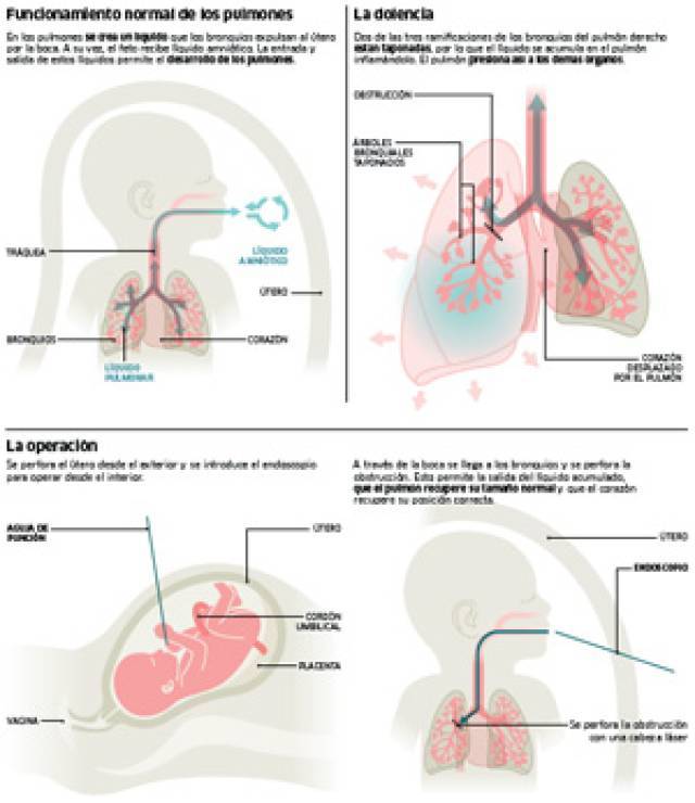 infografia