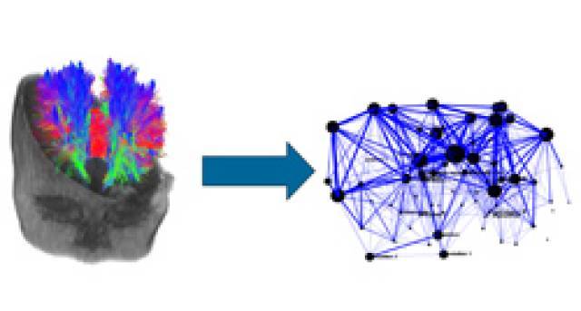 Esquema de la construcción de una red de conecitividad cerebral a partir de la integración de tractografía de un niño de un año y la parcelación automática de su cerebro en 59 regiones diferentes