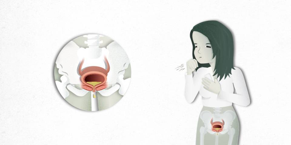 Urinary incontinence