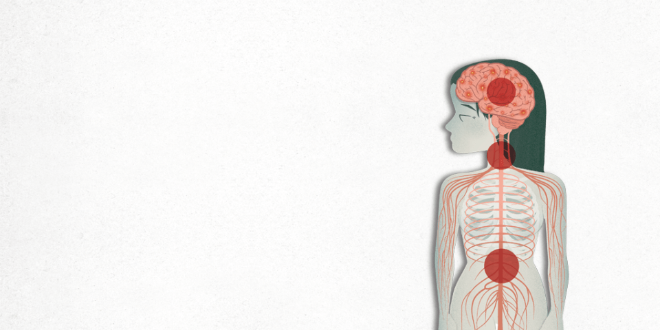 ¿Qué es la esclerosis múltiple?