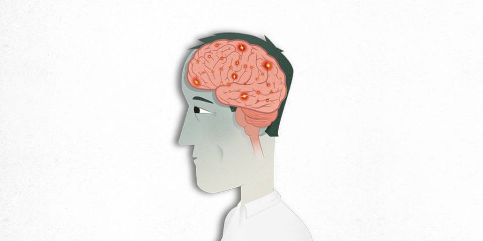 epilepsia