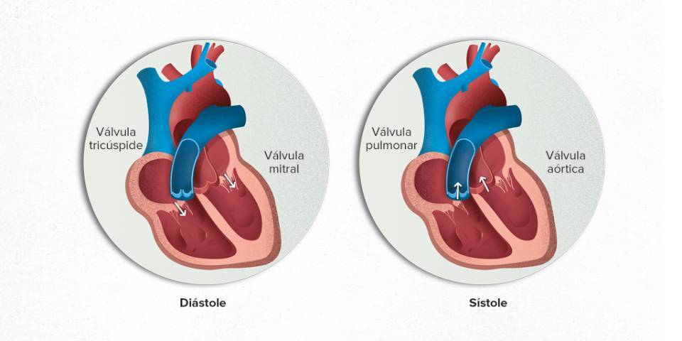 ¿Qué son las valvulopatías?