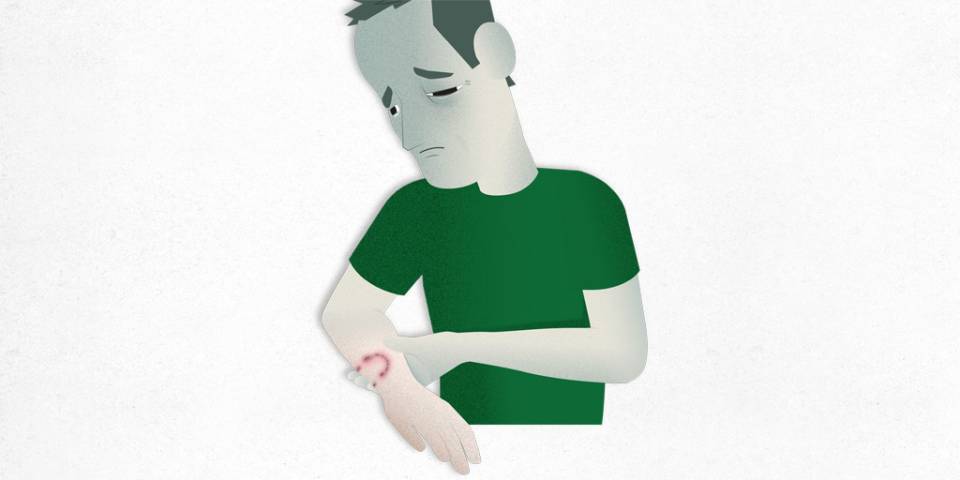 ¿Qué es la Rabia?