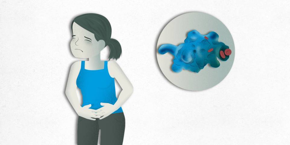 ¿Qué es la Amebiasis?