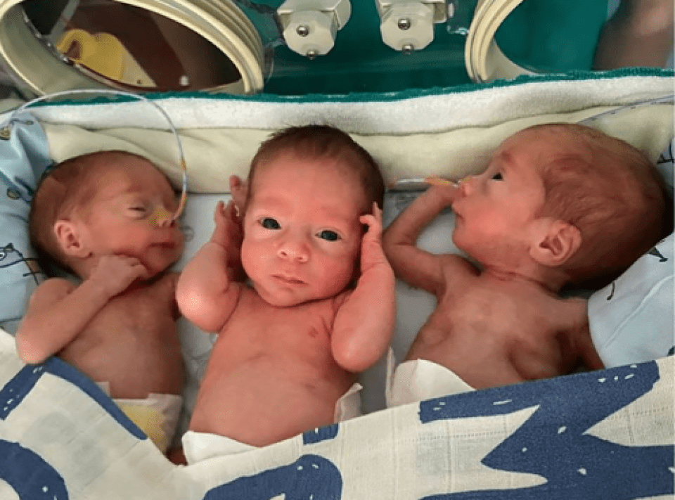 trigemins placenta unica