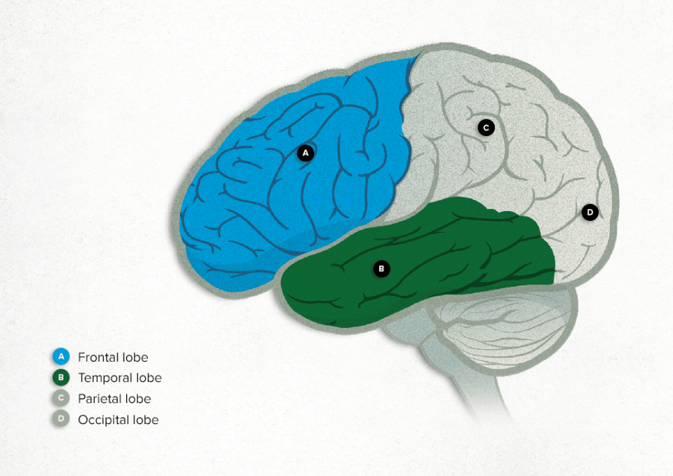 Demencia frontotemporal | Enfermedad de Pick