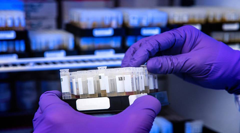 Early detection of a heart attack or stroke using biomarkers can significantly reduce mortality and morbidity.