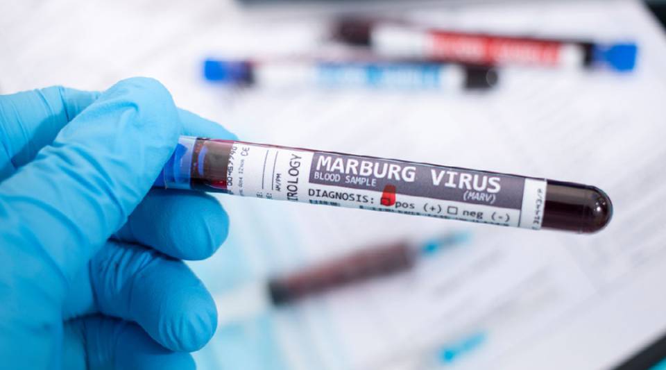 Marburg virus is a filovirus very similar to Ebola.