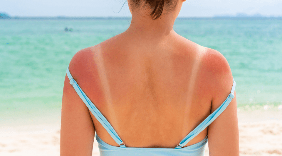 Tanning in the sun: according to each person's melanin