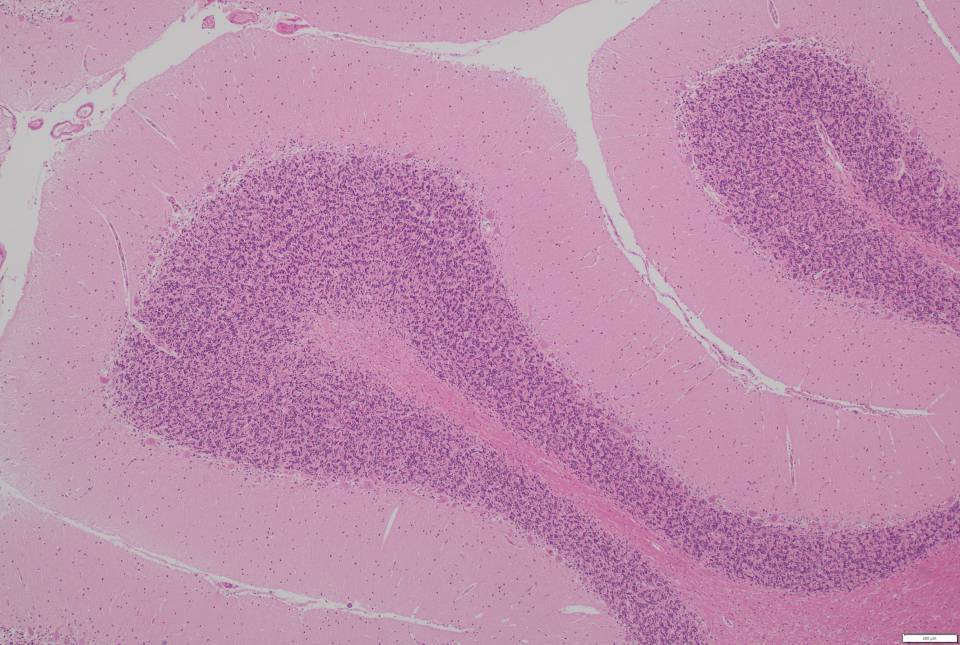 Neurological Tissue Bank
