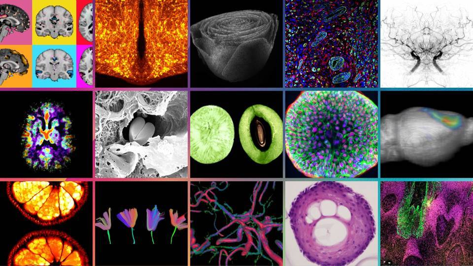 Inauguración de la exposición fotográfica del IDIBAPS en Vil·la Urània