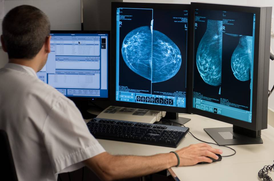 Postprocés i reconstrucció d’imatges diagnòstiques i informació de proves diagnòstiques