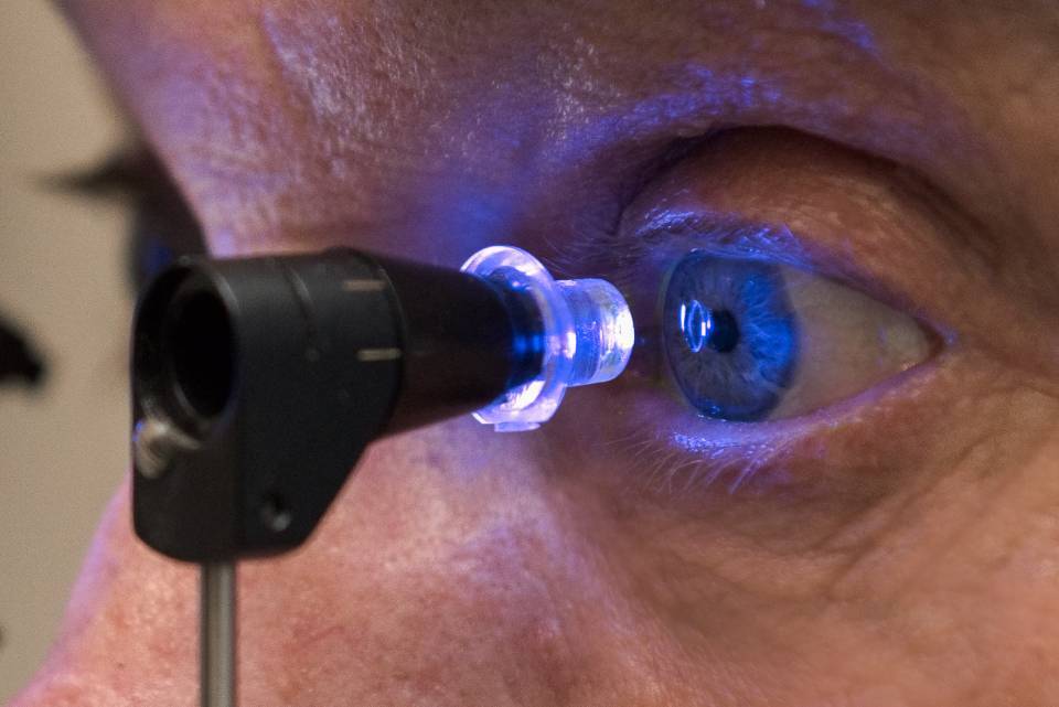 Detección de la PIO con iCare y explicación del glaucoma