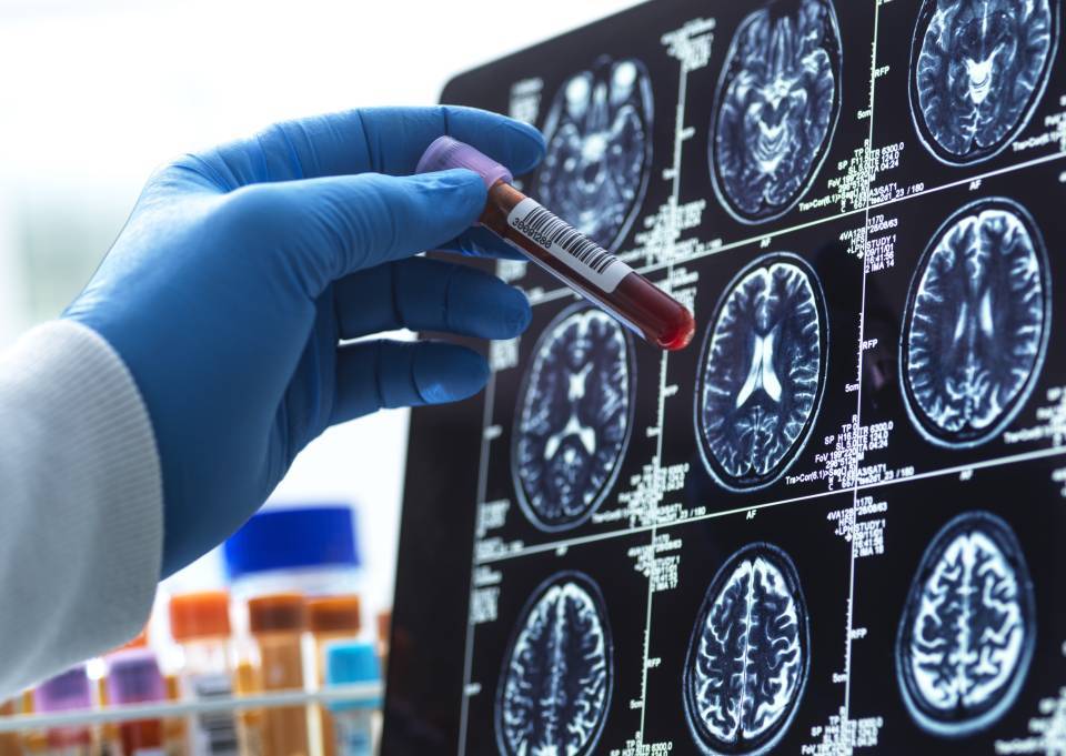 Enfermedades minoritarias