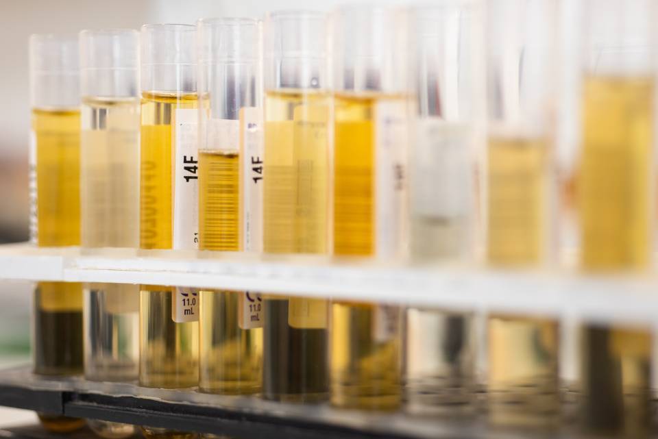 Cáncer de vejiga: detección precoz e investigación en cribado (Proyecto FIS)