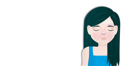 Pruebas y diagnóstico del Lupus | Hospital Clínic Barcelona