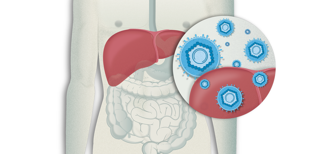 Qué es la Hepatitis Vírica? | Hospital Clínic Barcelona