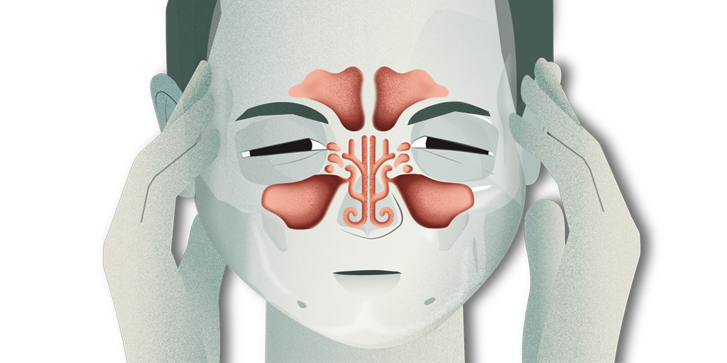 Qué es la Rinosinusitis? | PortalCLÍNIC