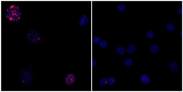 New cellular reprogramming technique counters hallmarks of aging ...