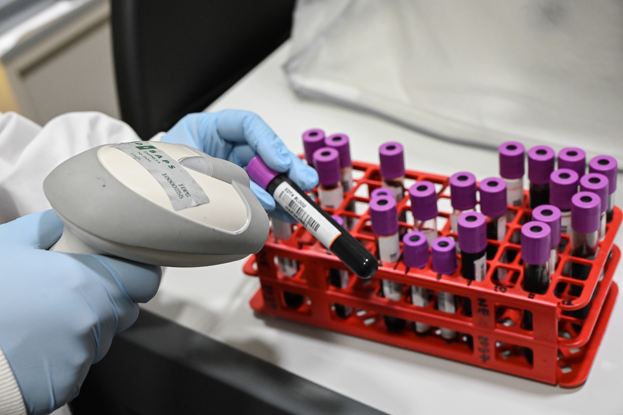 El IDIBAPS, reacreditado nuevamente como instituto de investigación