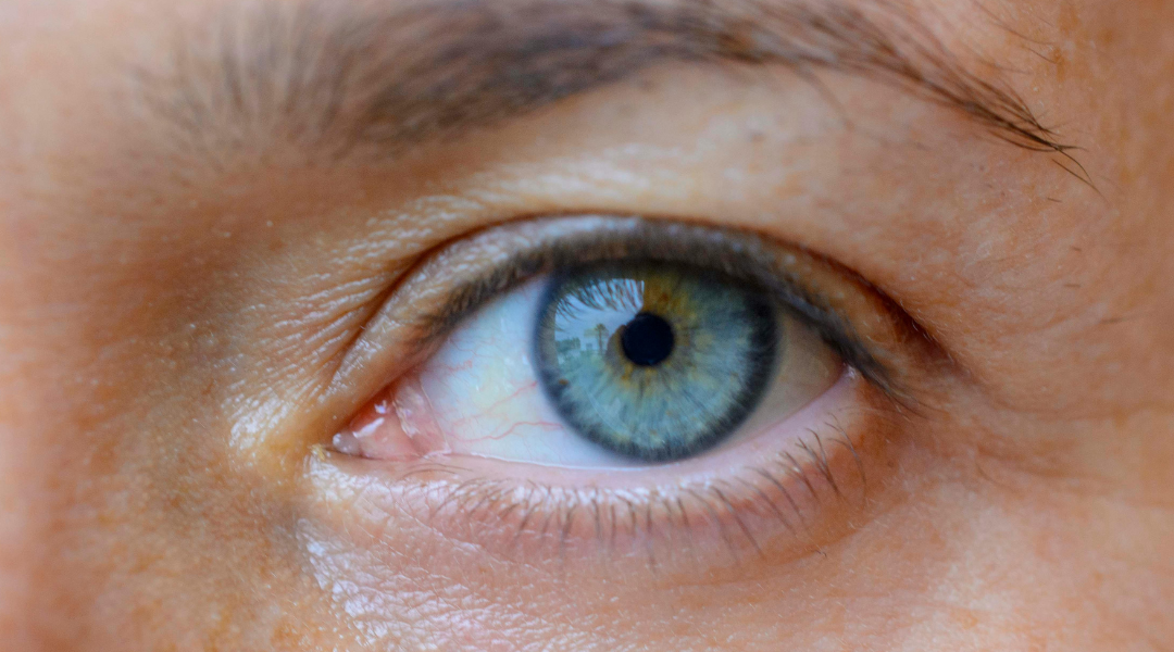 Changing eye colour: a trend that can pose serious risks to visual health